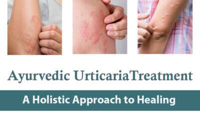 Ayurvedic Urticaria Treatment: A Holistic Approach to Healing